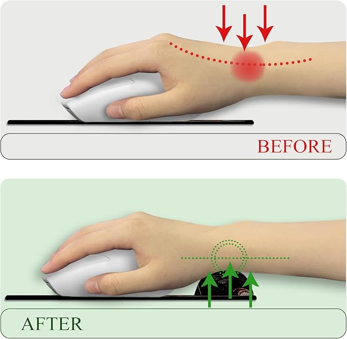 Mushroom Mouse Pad with Wrist Rest, Ergonomic Mouse Pad Wrist Support with Non-Slip Pain Relief PU Base, Funny Gaming Computer Mousepad, Cute Office Supplies Home Desk Accessories Decor